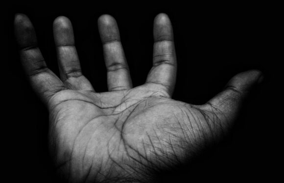 Open hand with palm facing the camera, grayscale with visible lines and wrinkles against a dark background.